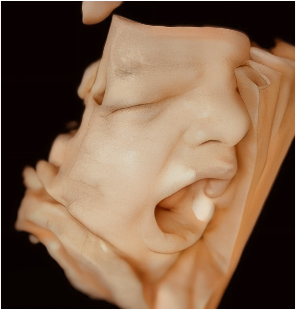 The ability to perform a yawn indicates proper development and coordination of the fetal facial muscles and nervous system